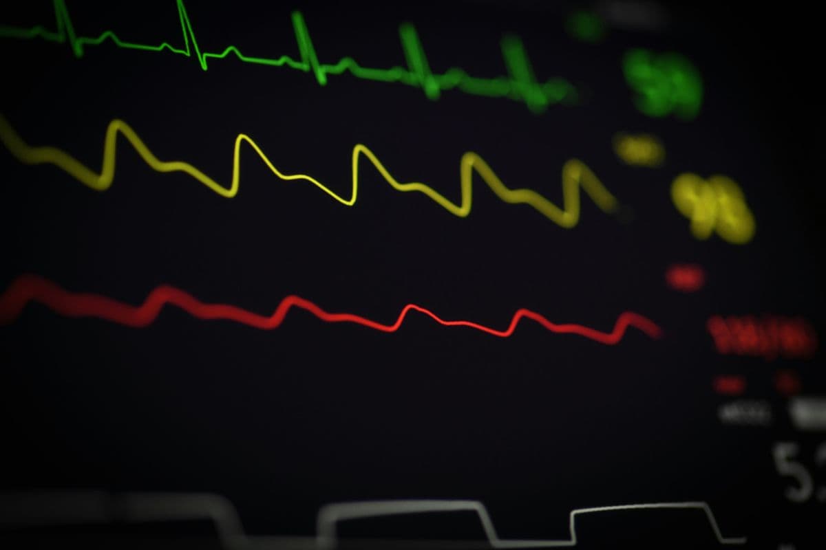 An image of a monitor showing an ECG, blood pressure, and pulse oximetry as reviewed by a veterinary cardiologist